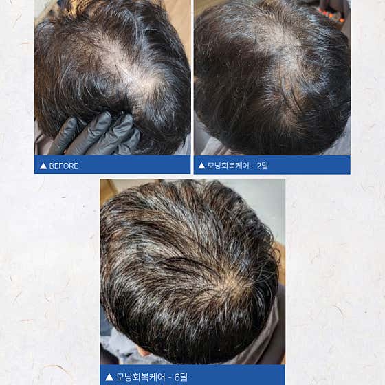 Medimo Scalp & Hair Loss Center Main Branch