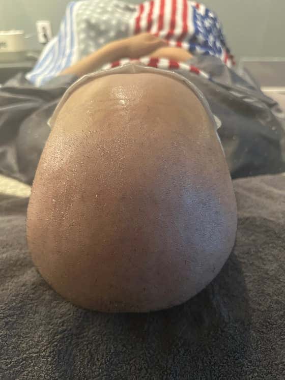 Centum頭皮研究所