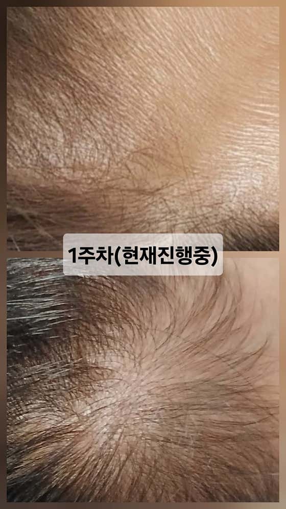 수비뷰티