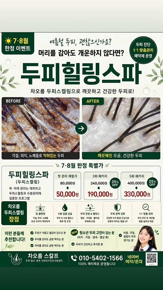 차오름 스칼프