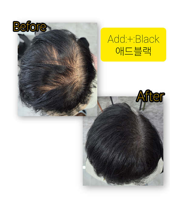 애드블랙