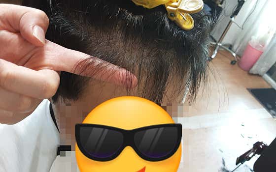 Men's Scalp
