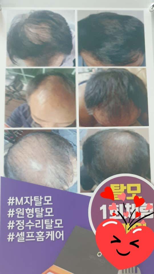 두피셀프케어