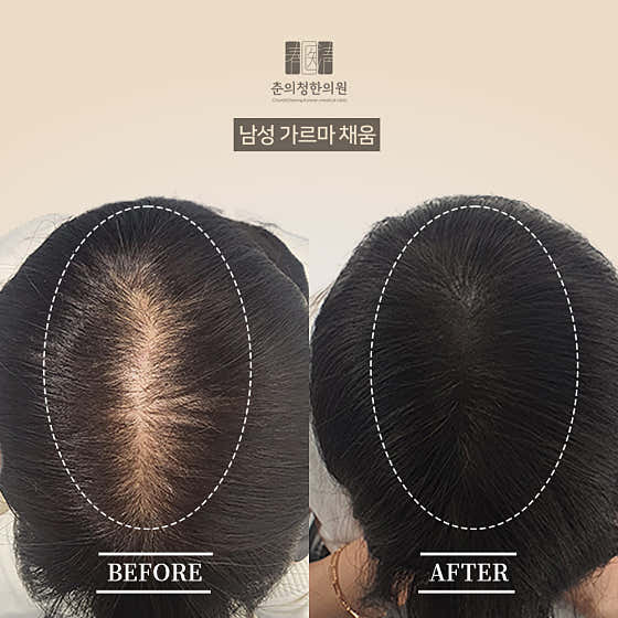 Chunuicheong Aesthetic