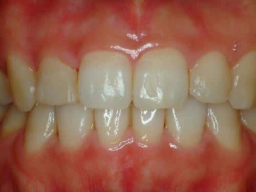 Jang Imun Plus Dental Clinic