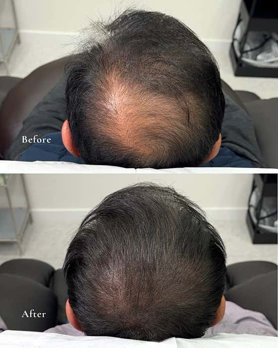 Number One Hair Loss Care Daejeon Branch