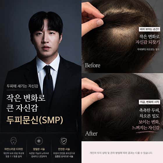 Mosup Scalp & Hair Loss Sejong Branch