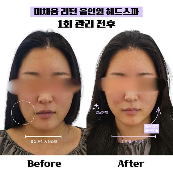 Michaeum Scalp & Head Spa Songpa Branch