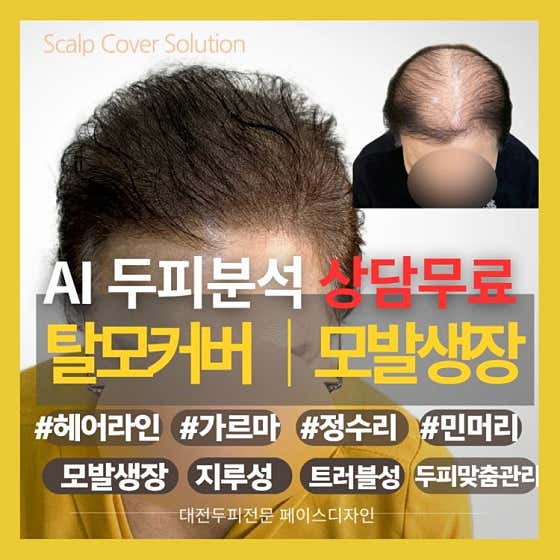 대전두피전문 페이스디자인