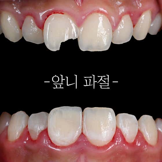 레진치과의원