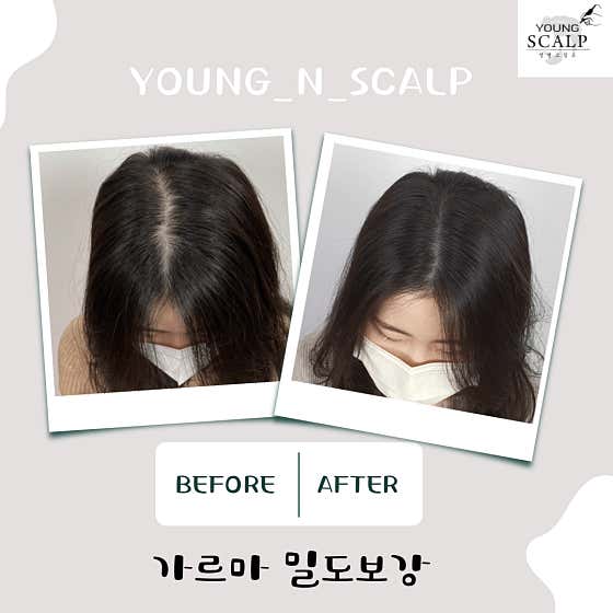 Young & Scalp