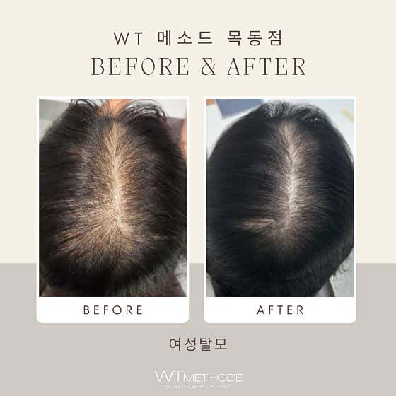 WT Method Mokdong Branch