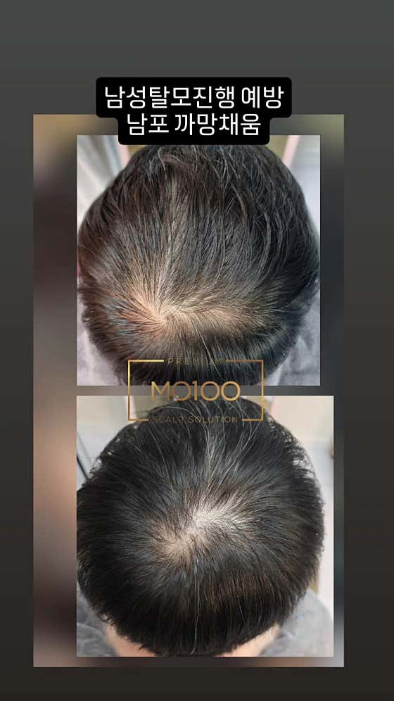 까망채움스칼프