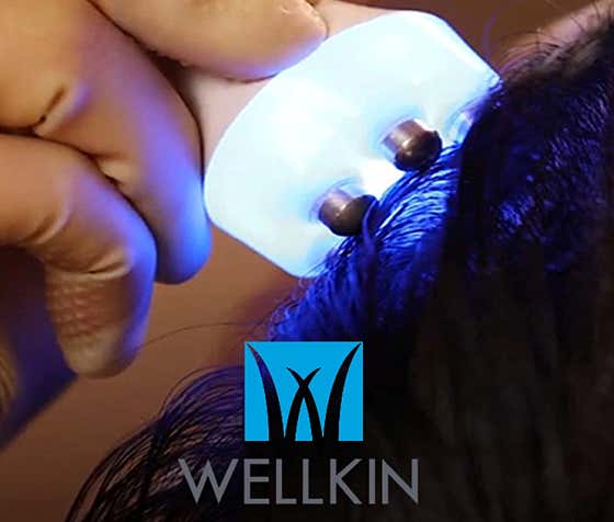 Welkin Scalp & Hair Loss Center Seomyeon Branch