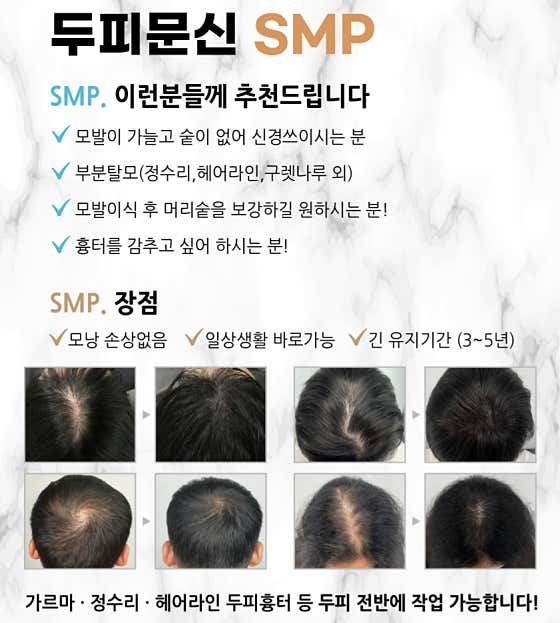 J Beauty & Scalp & Hair Loss