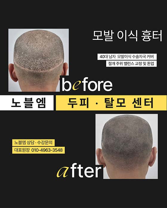 Noble M Barber Scalp & Hair Loss Center Hongdae