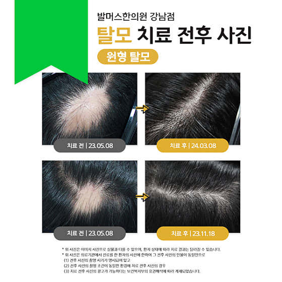 Balmers Korean Medicine Clinic Gangnam