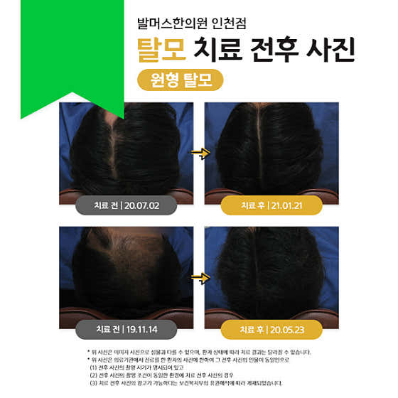 Balmers Korean Medicine Clinic Incheon