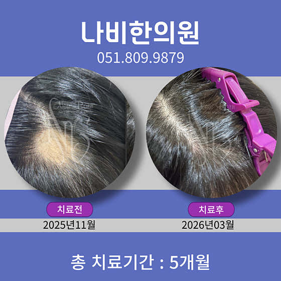 나비한의원 부산 서면