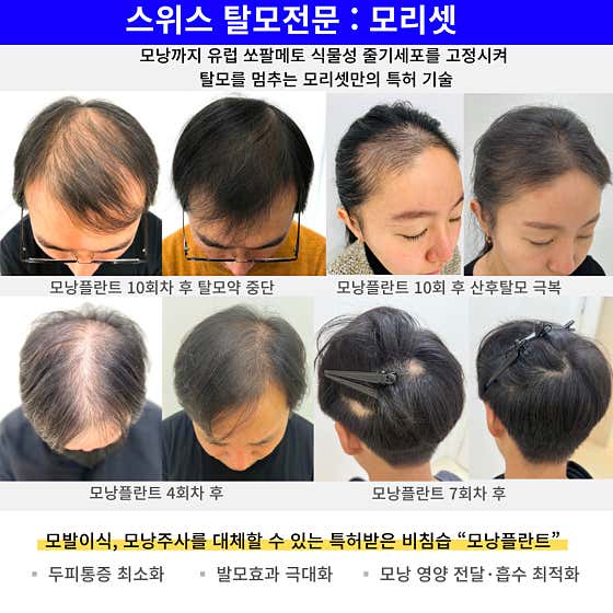 Morissette International Tok Tok Coupon Scalp & Hair Loss Care