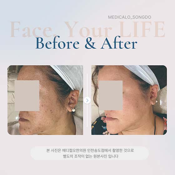 Medical O Korean Medicine Clinic Incheon Songdo Branch