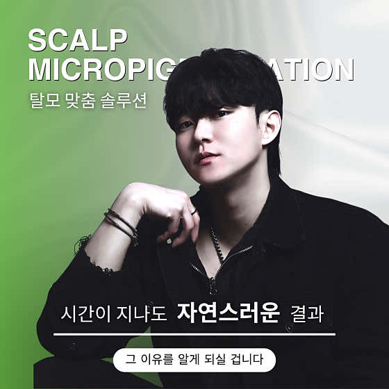 Vita SMP Tok Tok Coupon Scalp & Hair Loss Care