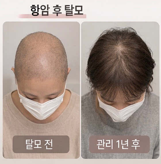 Moriset頭皮再生中心昌原分部