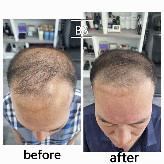 Black Scalp