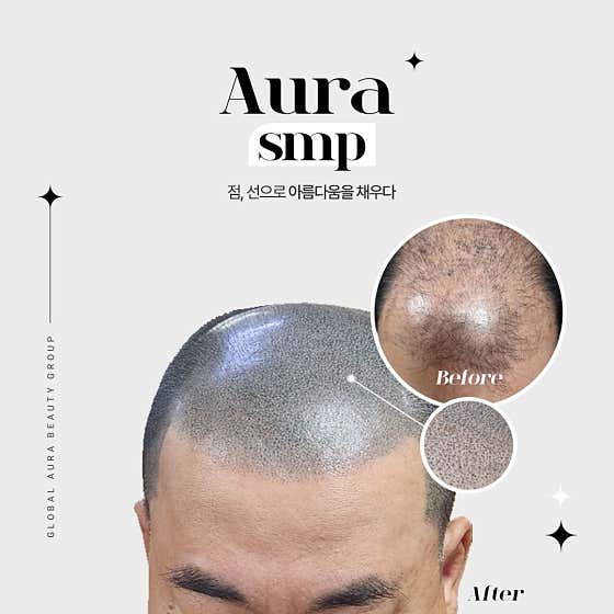 Aura Beauty SMP