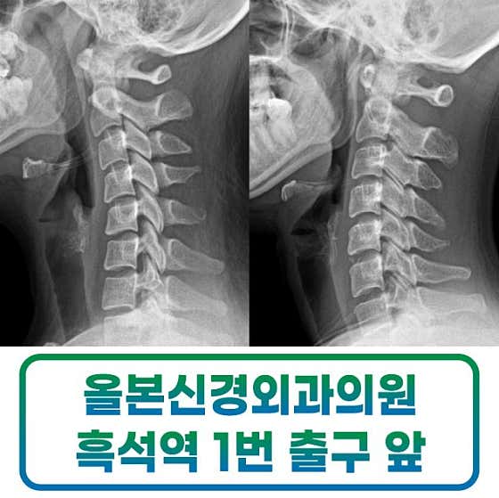 Olbon Neurosurgery Clinic