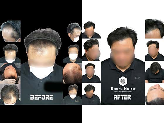 앙크르느와