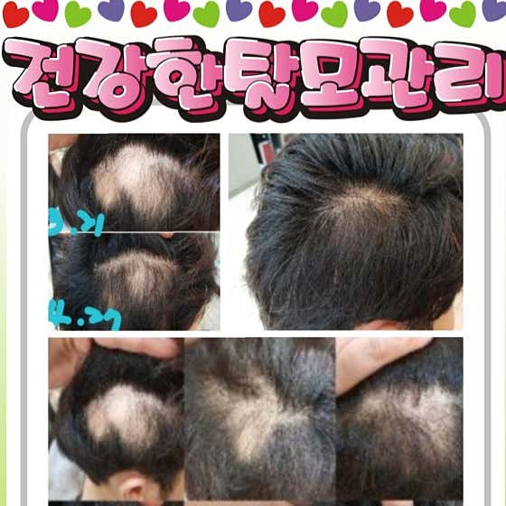 Korea Hair Loss and Scalp Specialists Association