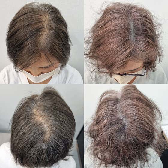 그리고채우다