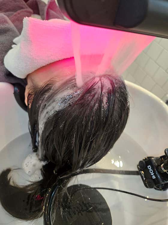 Scalp moment