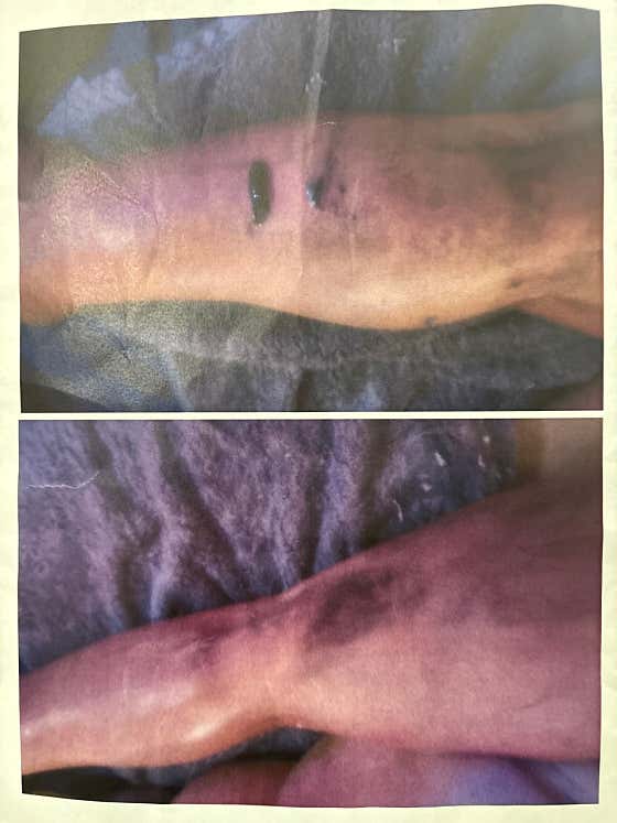 연 두피탈모케어 스킨 바디