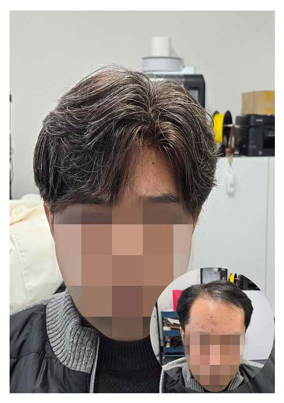 黑點