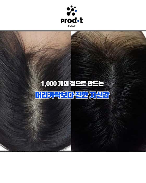 프로닷스칼프
