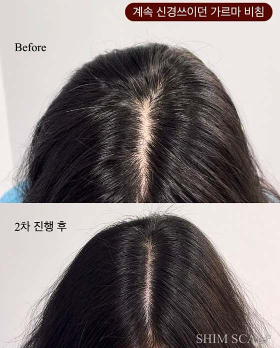쉼스칼프