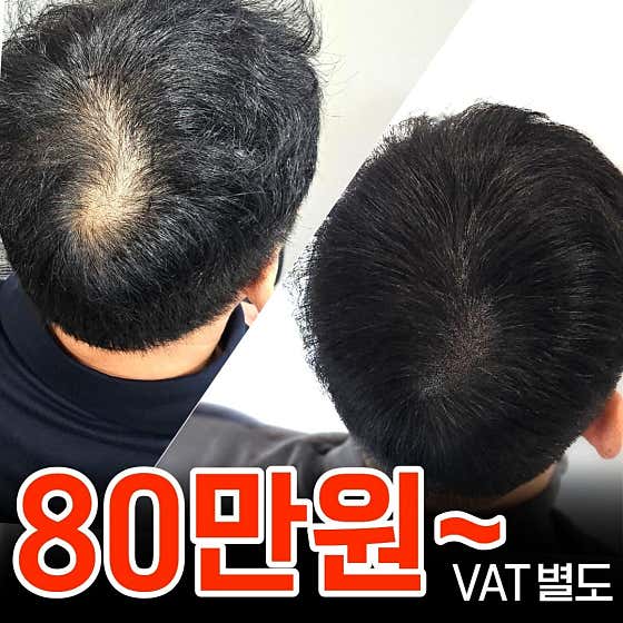 대구JK 두피문신센터