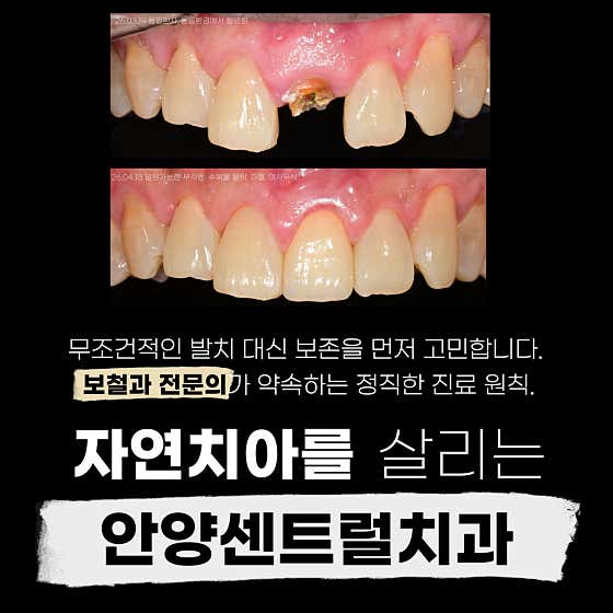 Anyang Central Dental Clinic