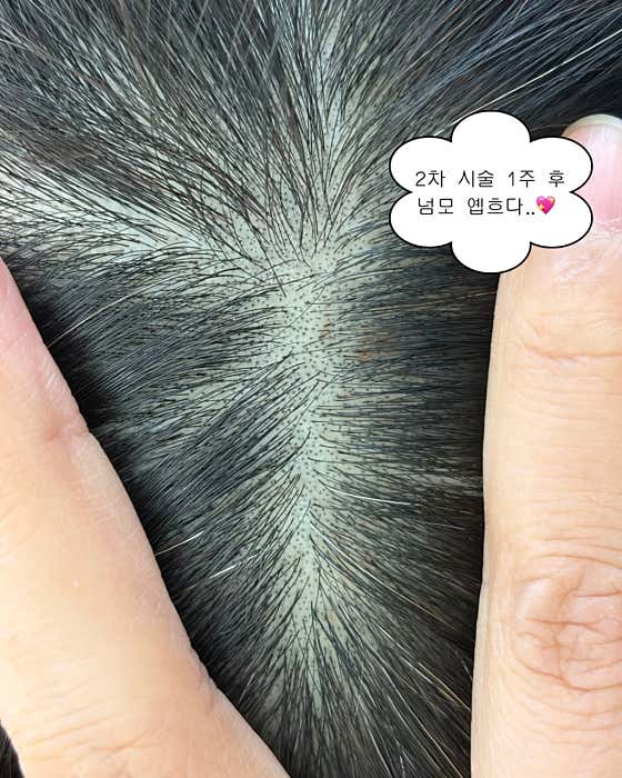 SolidScalp