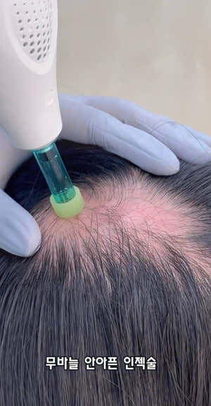 The Goeun Scalp Specialty Center