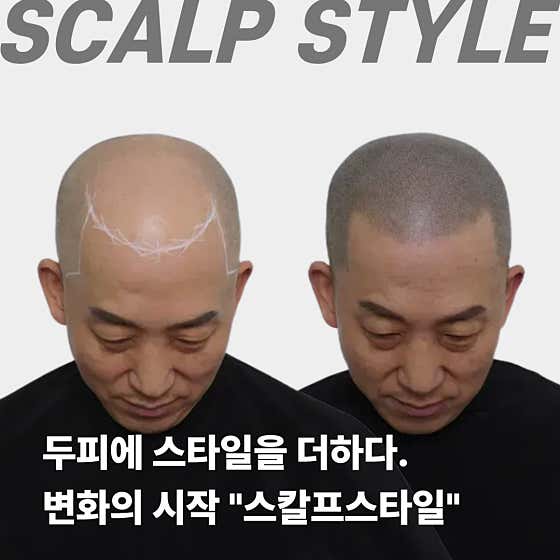 스칼프스타일