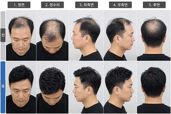 청주모사랑 가발