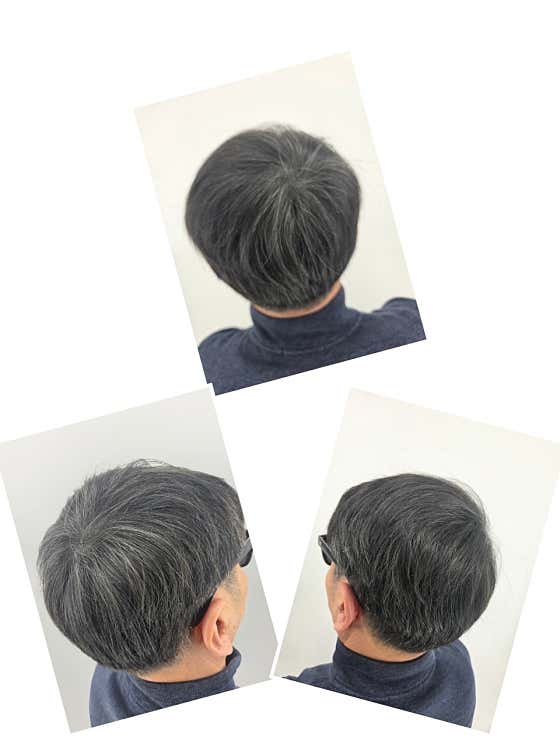 Hair Loss Master