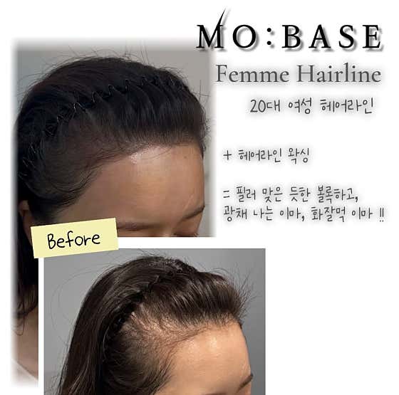 Mobase Scalp 南陽州分部