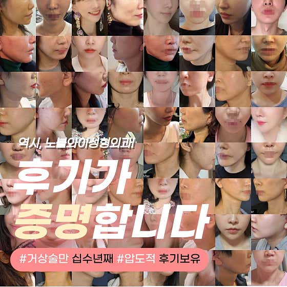노블와이성형외과의원