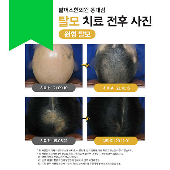 巴爾默斯韓醫診所弘大分院