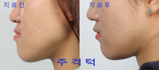 하이치과의원