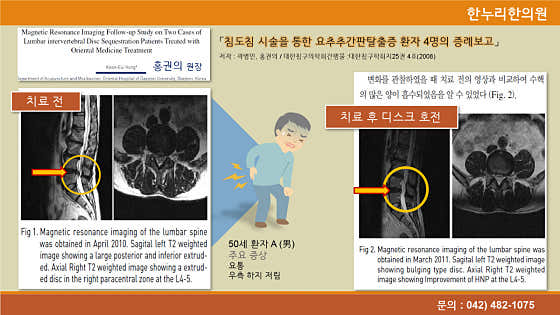 Hannuri Korean Medicine Clinic